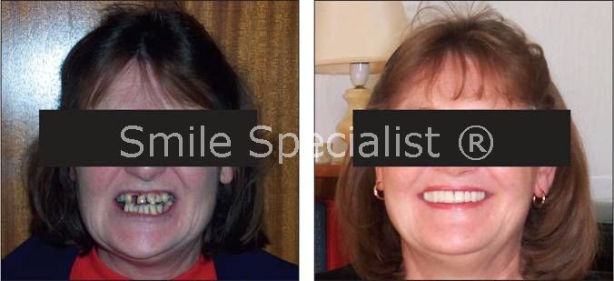 Dr Kilcoyne's Smile Specialist patient makeover before and after